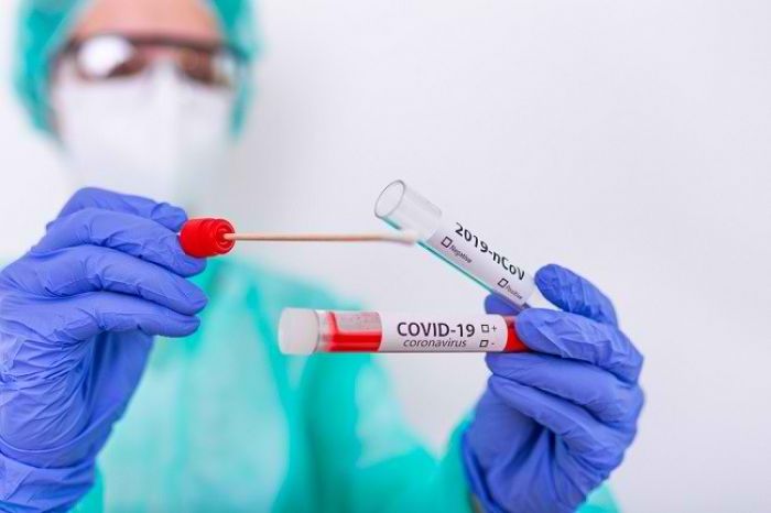 Mengenal Rapid Test Antigen yang Kini Jadi Syarat Perjalanan