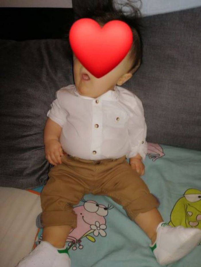 Perjuangan 'Bayi Tanpa Wajah', Tak Punya Mata dan Hidung, Berhasil Patahkan Vonis Dokter