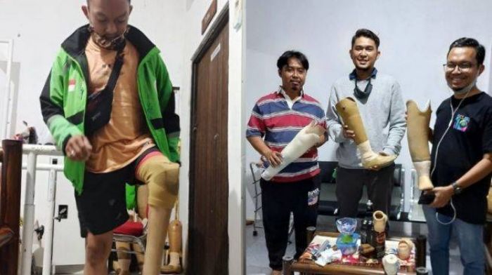 Sempat Viral, Akhirnya Impian Driver Ojol Dapat Kaki Palsu Terwujud