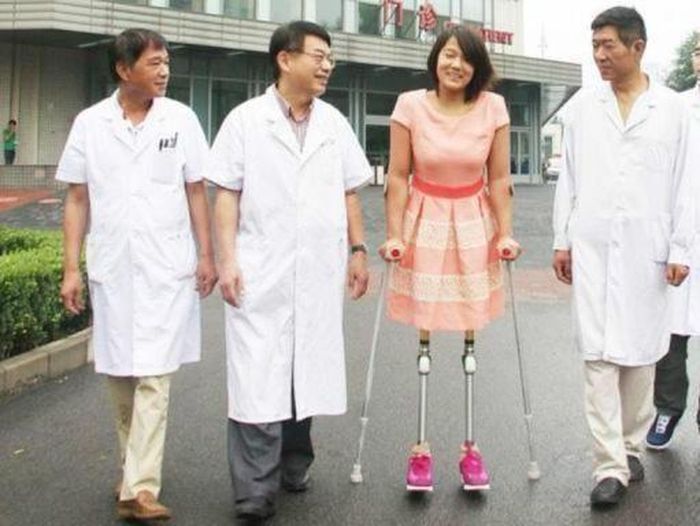 Mengagumkan, Ini Penampilan Cantik Bocah Berkaki Bola Basket Saat Dewasa