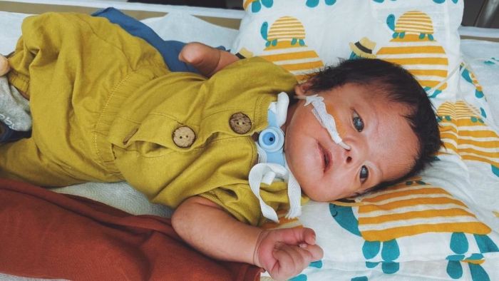 Kisah Hiro, Bayi yang Terserang Moebius Syndrome Sebabkan Wajahnya Lumpuh