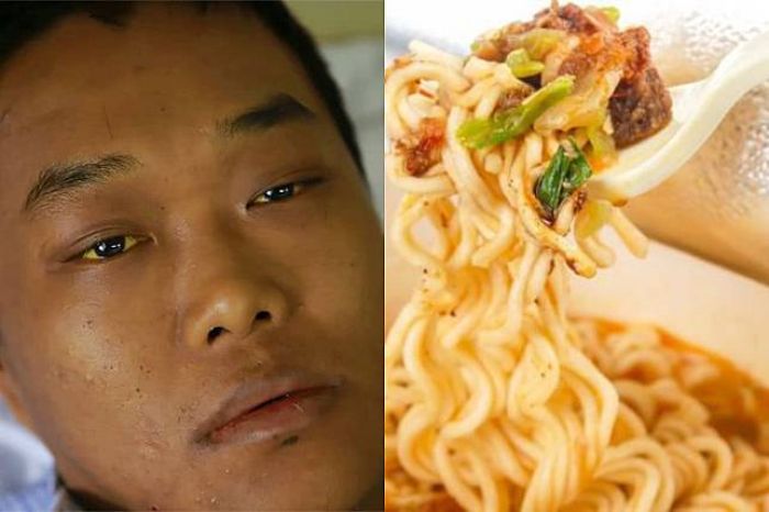 Akibat Sering Begadang dan Makan Mie Instan, Pria ini Terkena 16 Penyakit Kronis