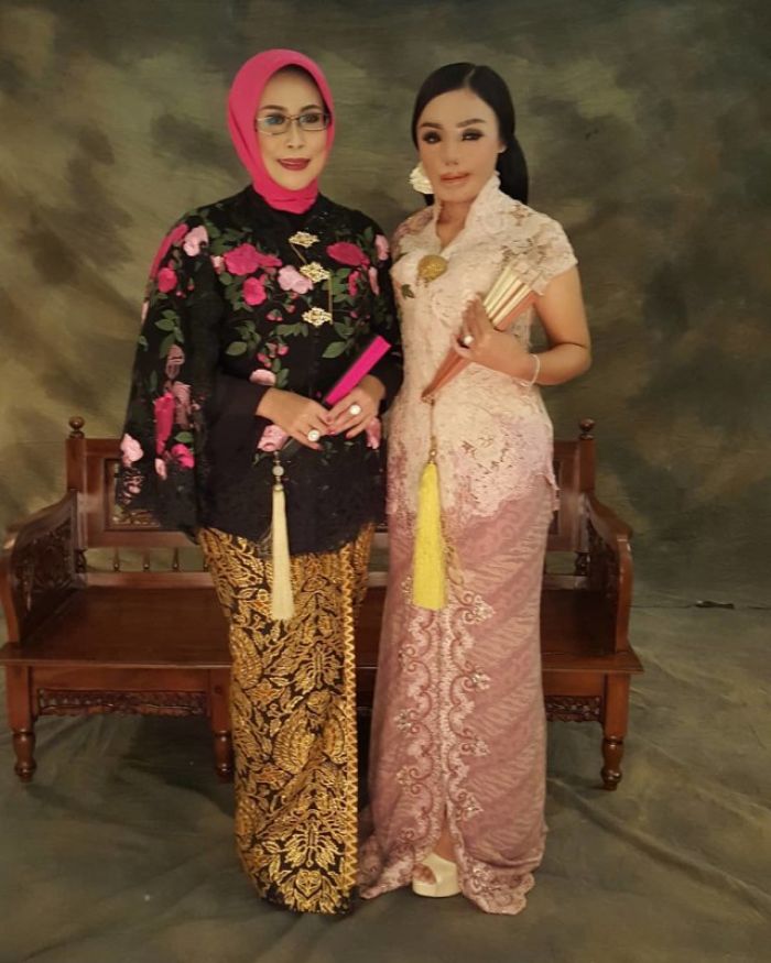 Lisa Korban Air Keras, Tegar Hadapi Ujian Hidup Kini Sukses Jadi Pengusaha Perhiasan