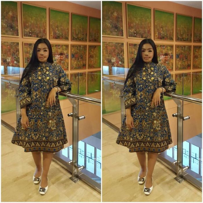 Lisa Korban Air Keras, Tegar Hadapi Ujian Hidup Kini Sukses Jadi Pengusaha Perhiasan